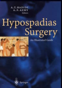 Hypospadiasis sebészet