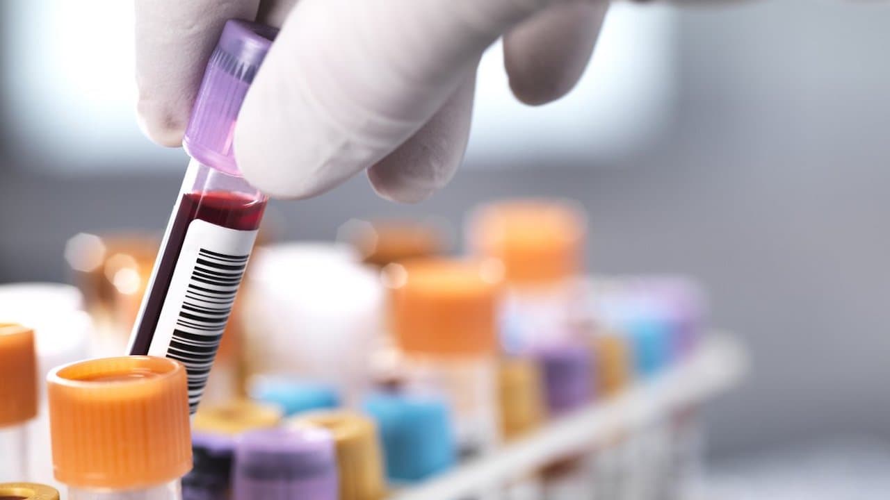 anti gad vizsgálat vércukor és inzulin mérő