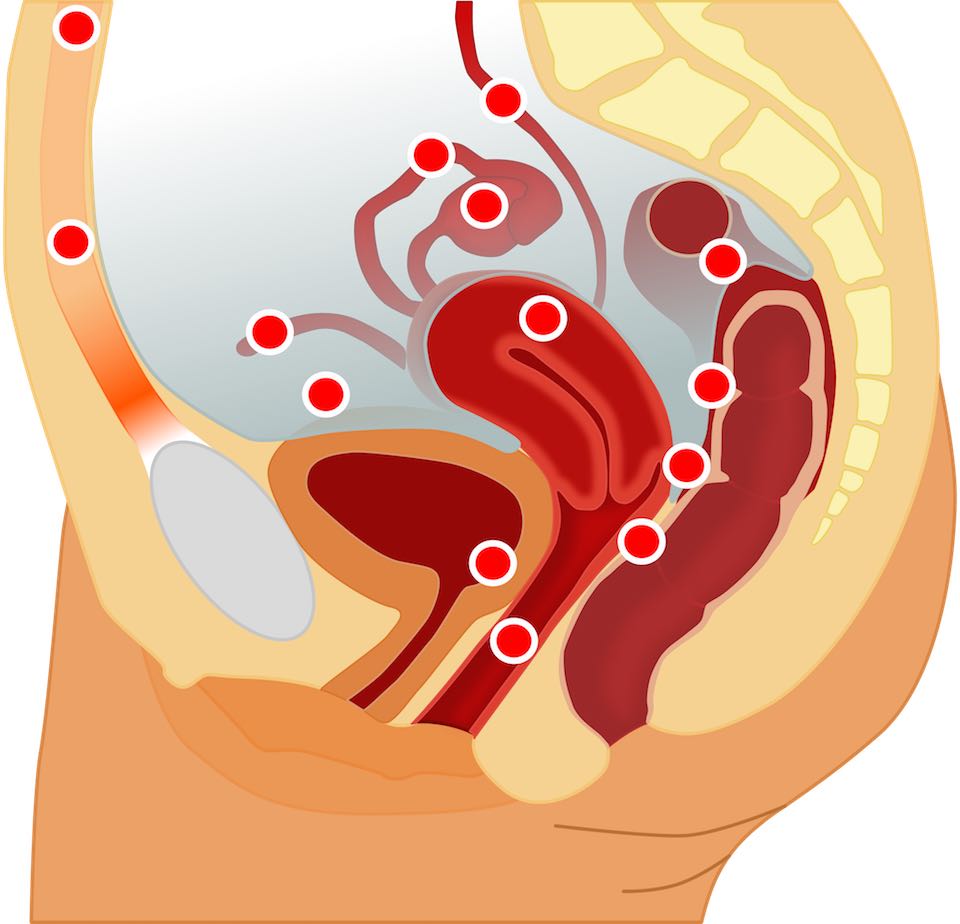 cukorbetegség hatása a menstruációra cukorbetegség kezelés áfonya levelei