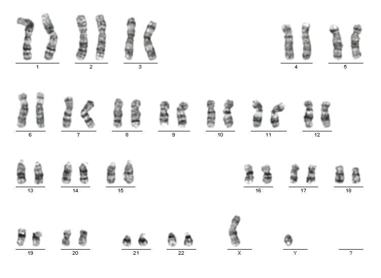 Normál férfi kromoszómakészlet