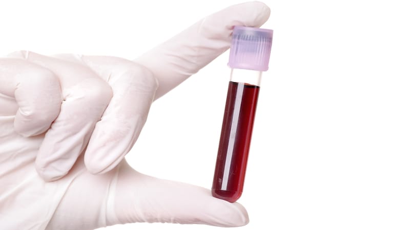 pca3 teszt vérből Antibiotikumok prosztatitis a férfiak nevében