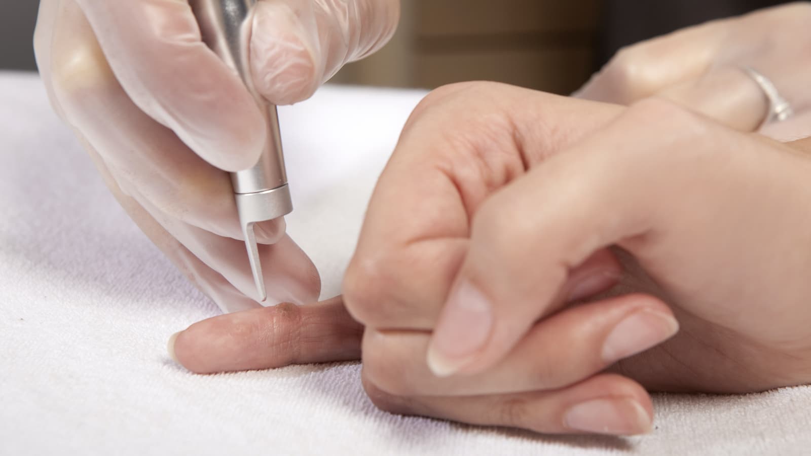 kézi körömfürdők a gomba ellen vinegar toenail fungus reddit