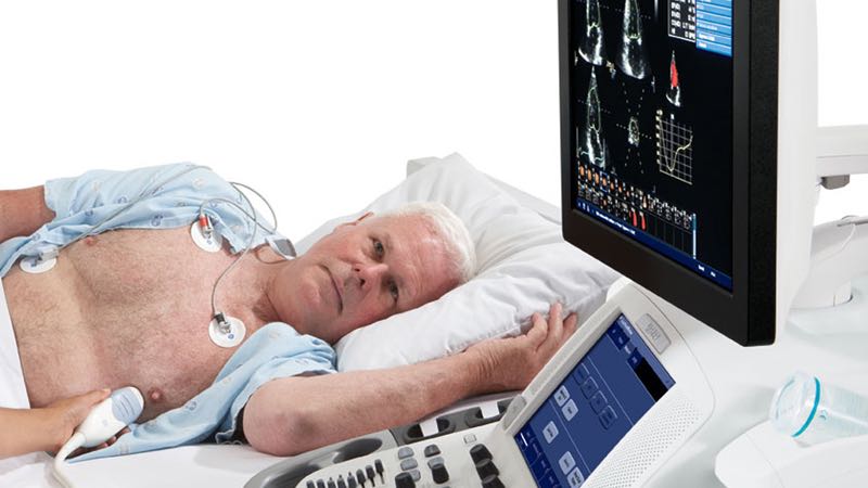 Szív ultrahang vizsgálat - Praxisp{o}nt szív kardiológia ekg